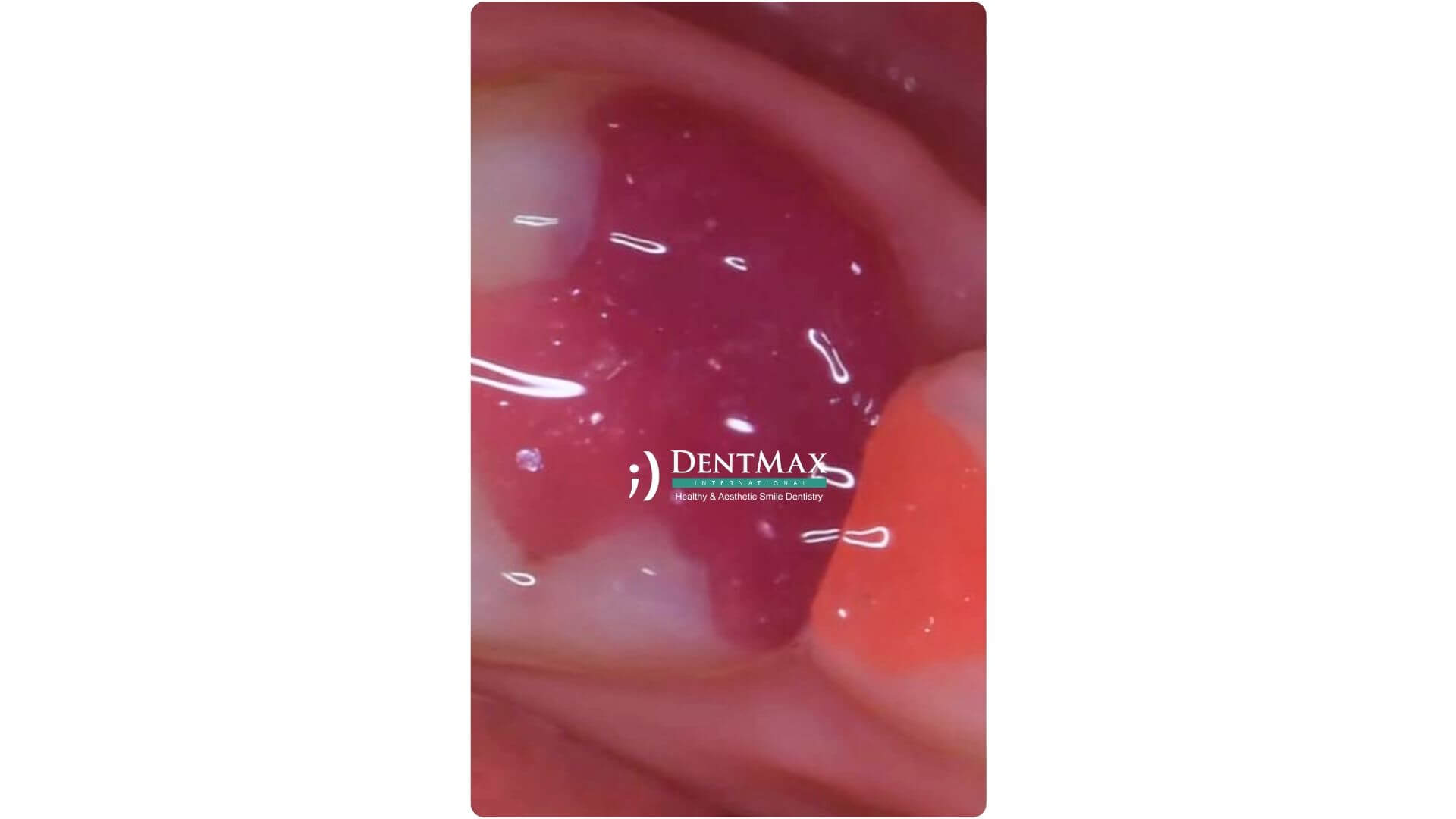 Dentmax Banner
