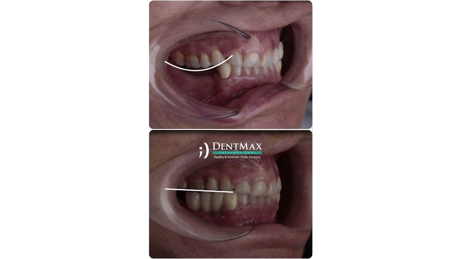 Dentmax Banner