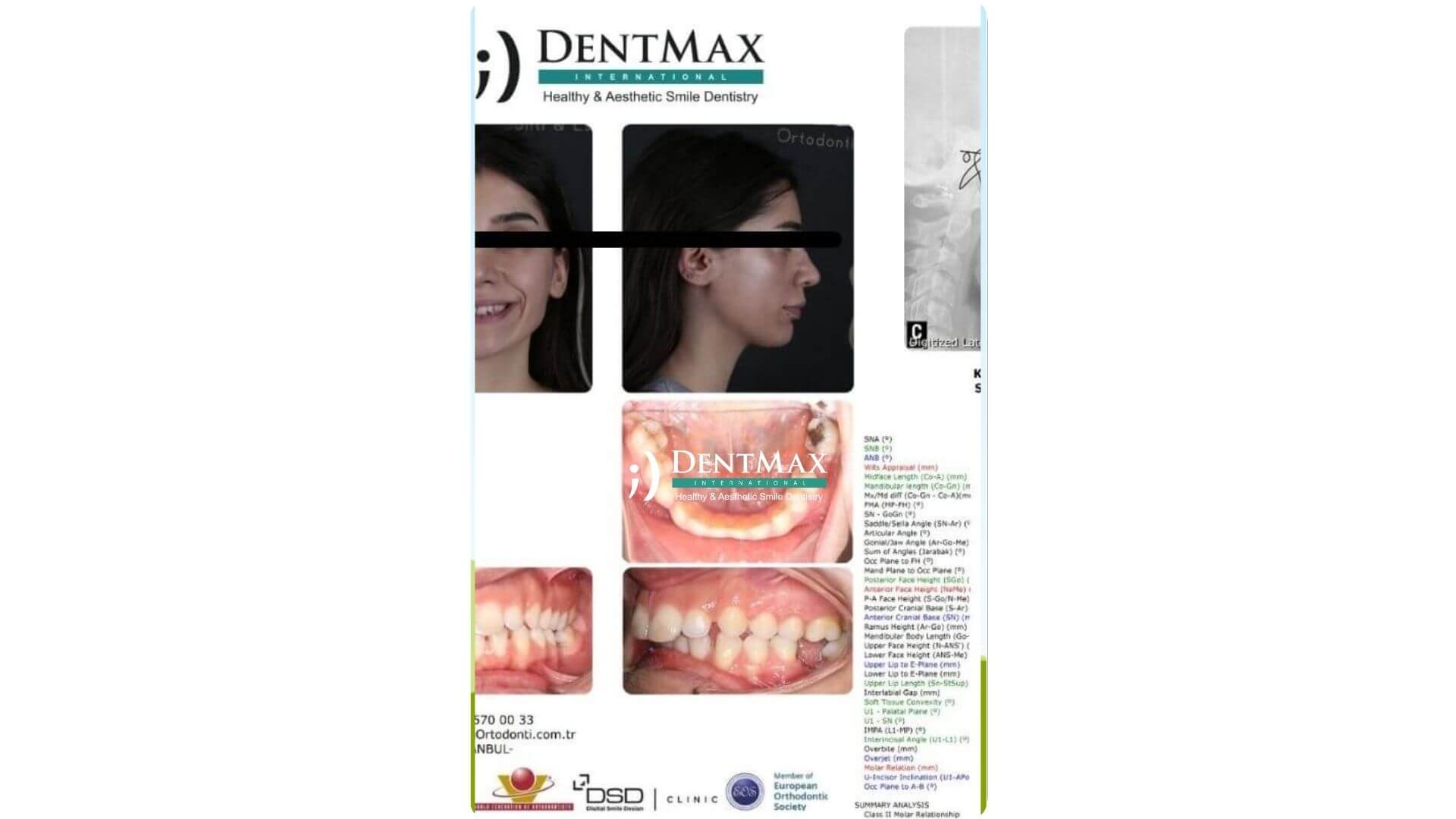 Dentmax Banner