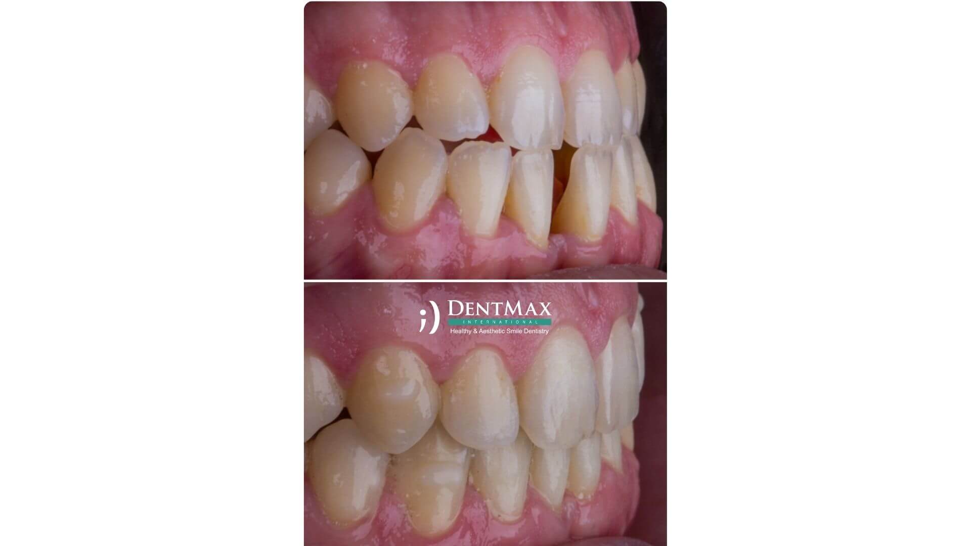 Dentmax Banner