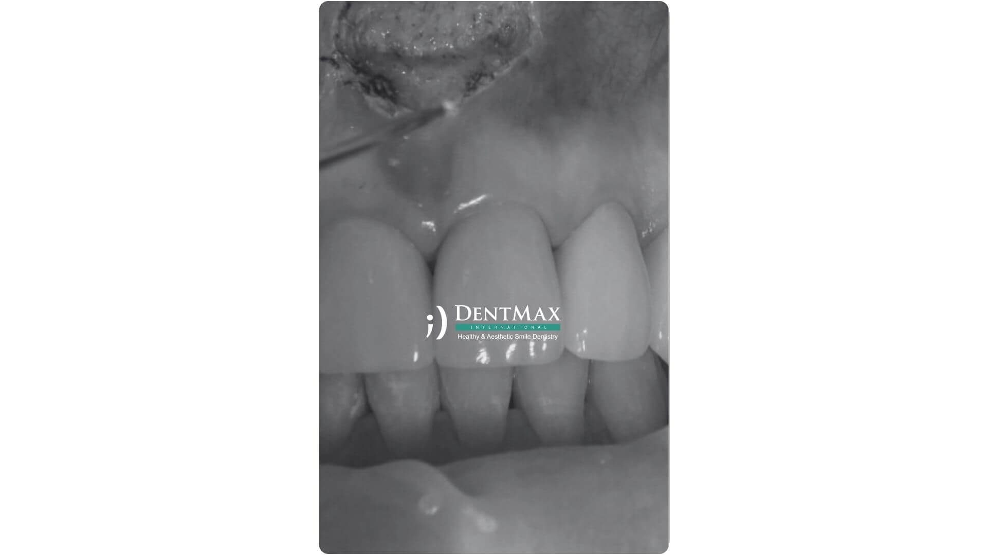 Dentmax Banner