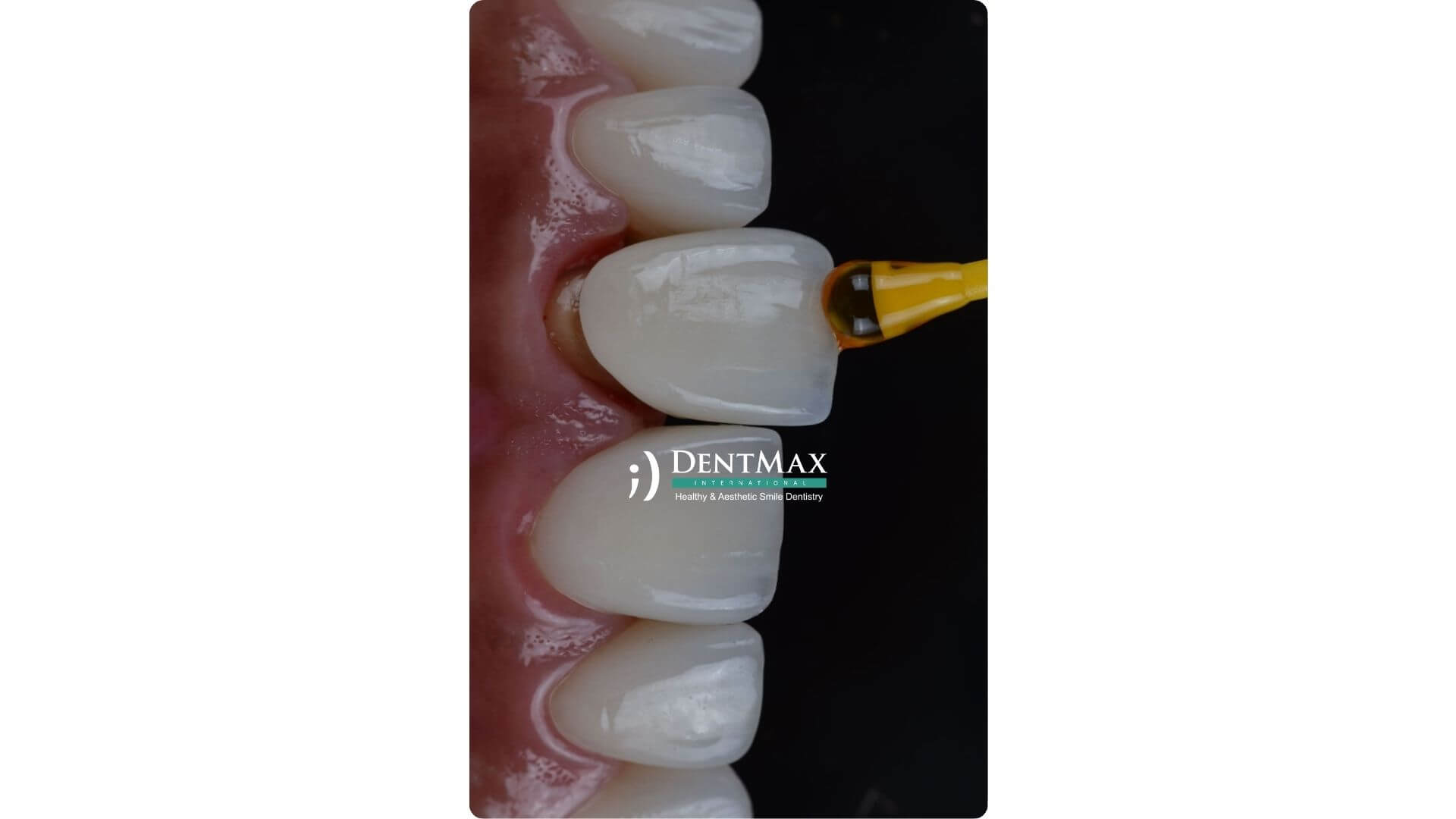 Dentmax Banner