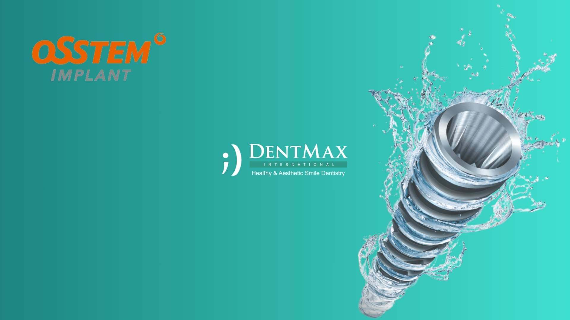 Dentmax Tedaviler