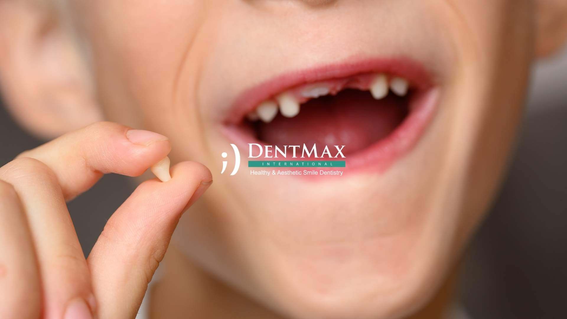 Dentmax Basından