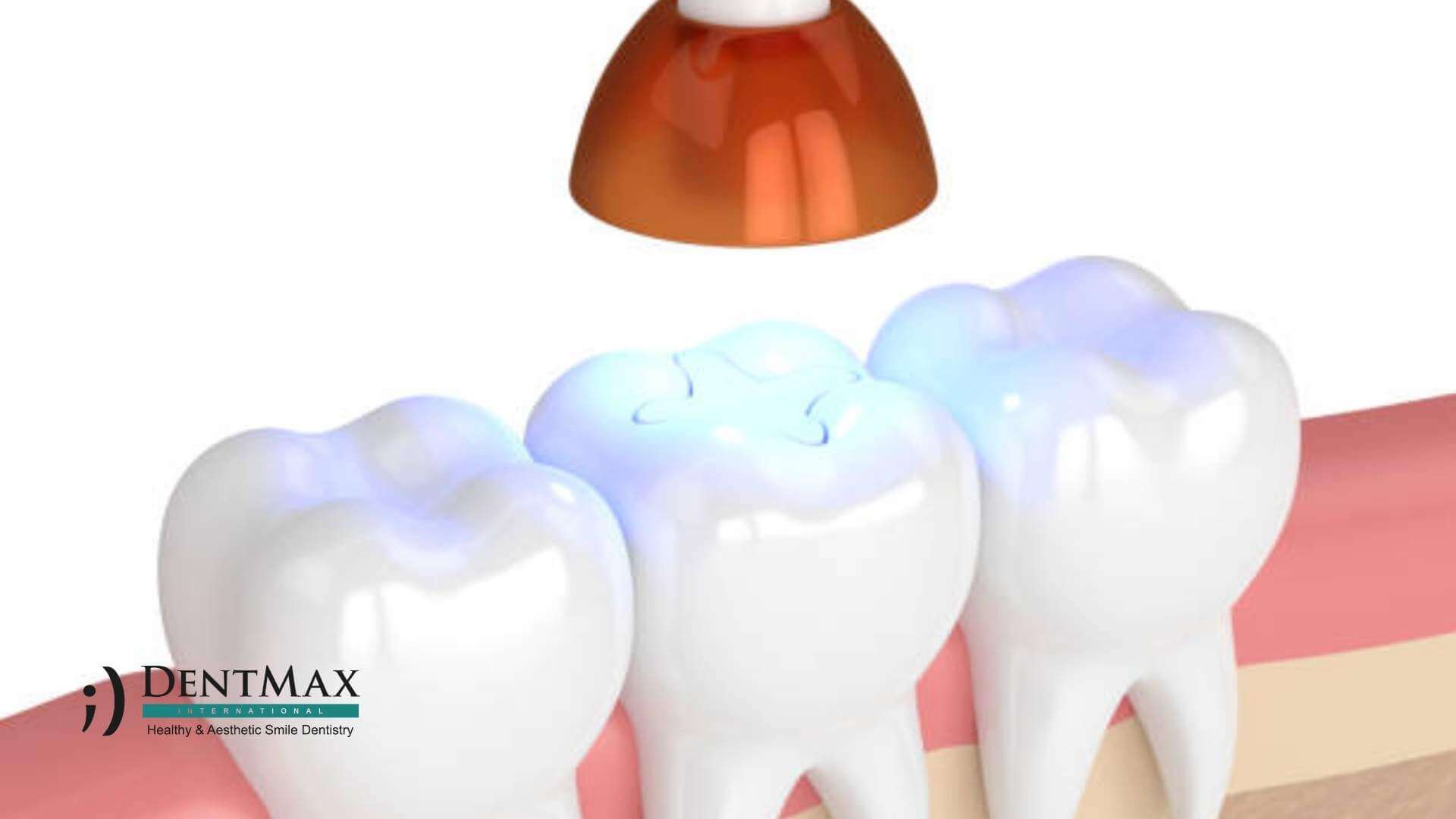 Dentmax Basından
