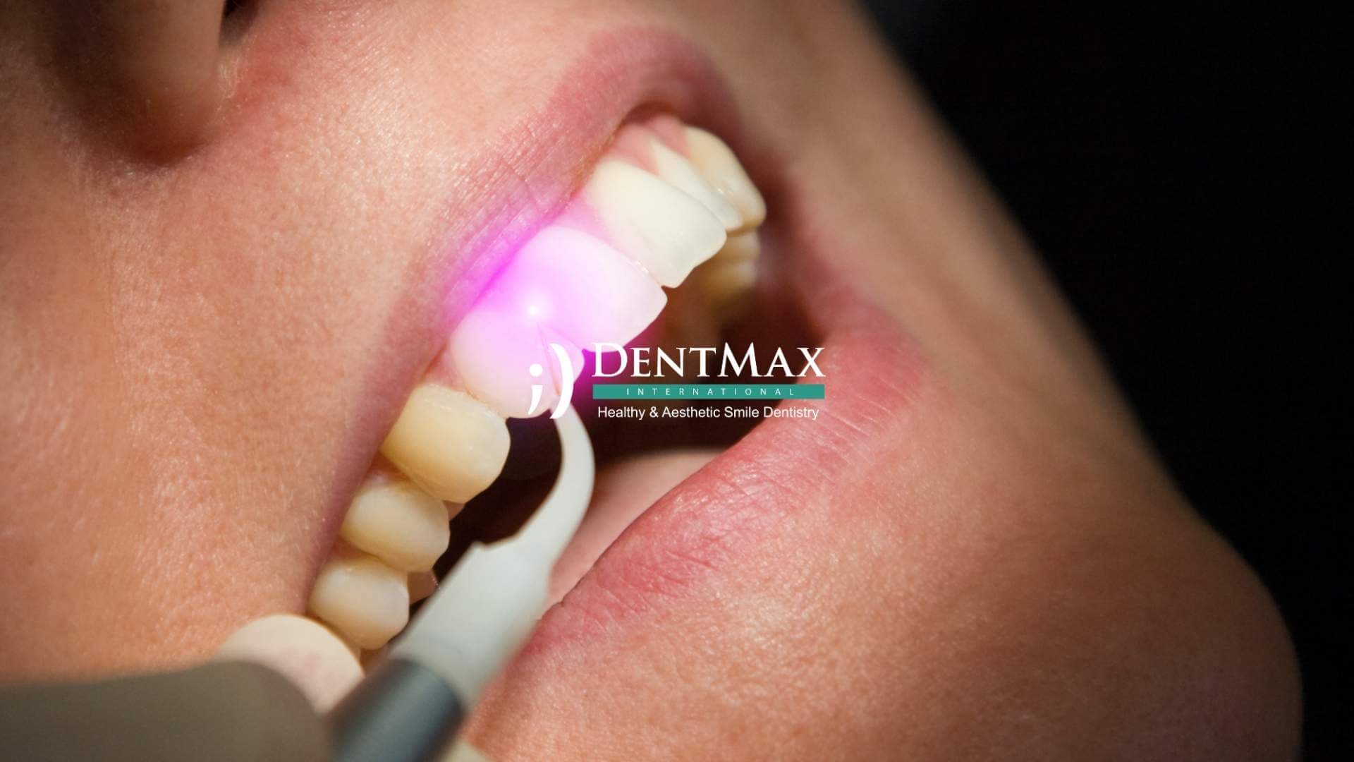 Dentmax Basından