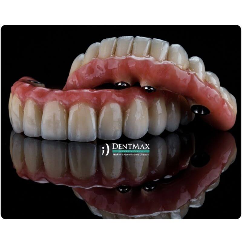 Dentmax