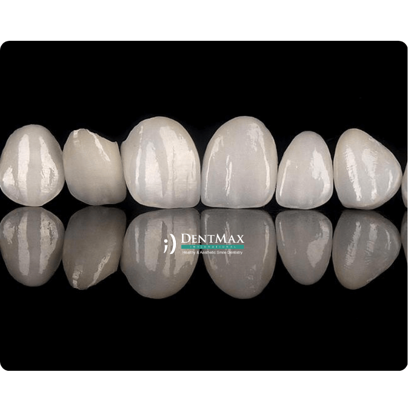 Dentmax